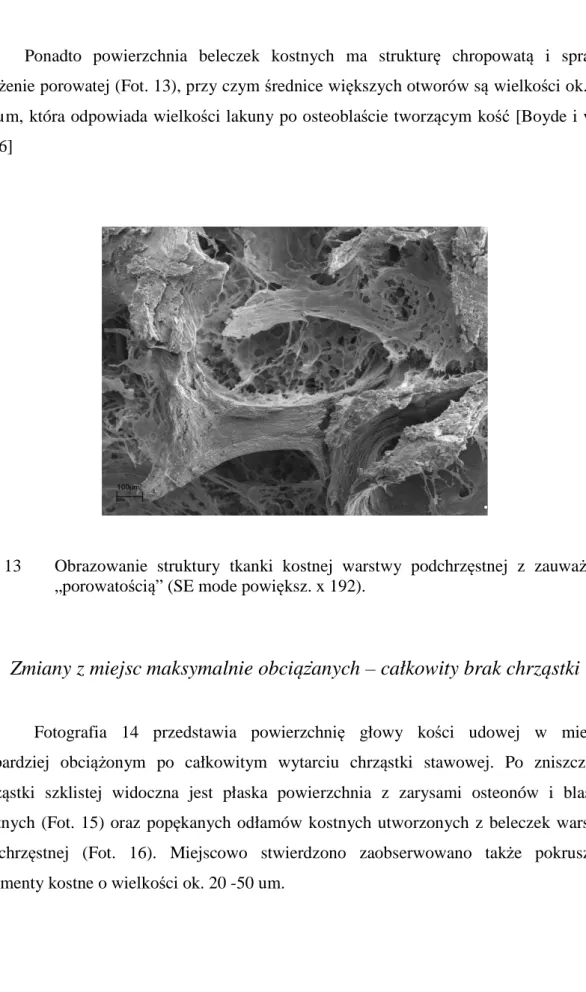 Fot. 13   Obrazowanie  struktury  tkanki  kostnej  warstwy  podchrzęstnej  z  zauważalną 
