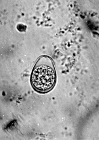 Fot. 2. E. zuernii i E. bovis (skala 0,02 mm; scale bar=0.02 mm)