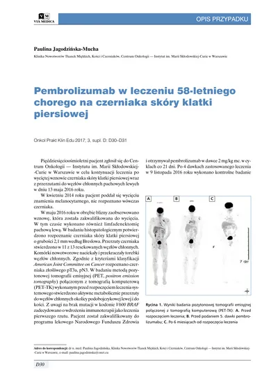 Pembrolizumab W Leczeniu 58 Letniego Chorego Na Czerniaka Skóry Klatki Piersiowej 1606