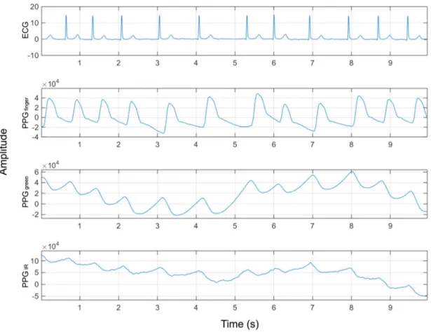 Figure 2. An example of ECG, fingertip and wrist (green and infrared) PPG waveforms.