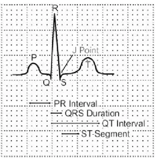 Figure 2.7 ECG waveforms and segments [17]