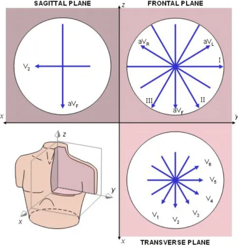 Figure 2.9 Bipolar (I, II, III) and unipolar (aV R , aV L ,aV F ) limb leads and the precordial leads V 1 to V 6 give a 3-dimensional view of the heart