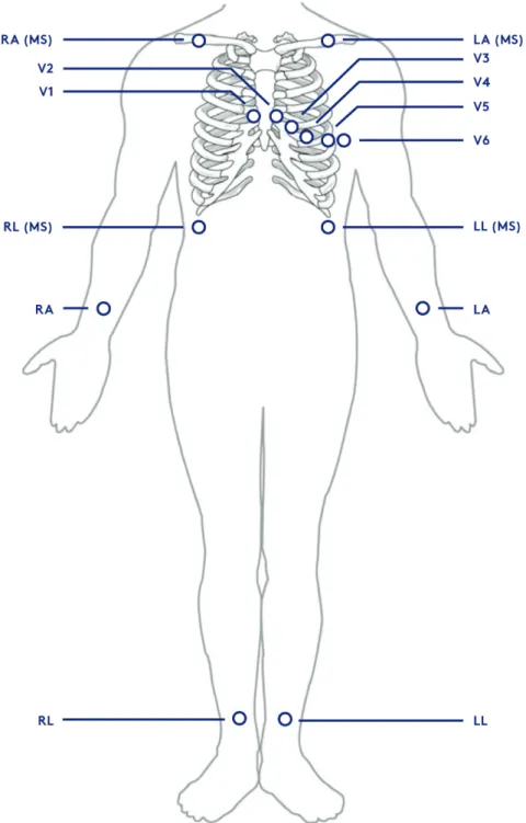 Figure 2.10 12-lead ECG lead positioning: Traditional conguration and the Mason- Likar conguration