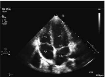 Figure 2. An echocardiography image of myocardium annotated with the locations of  various chambers [40]