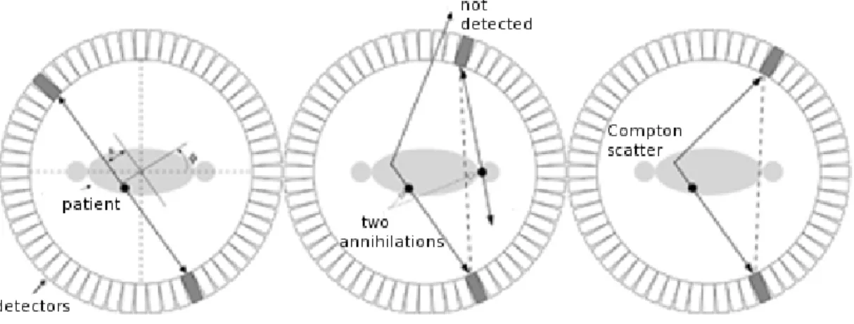 Figure  2.4: Transaxial view of a ring scanner. Left: A true coincidence. Middle: A random coincidence originates from two annihilation events happening at the same time