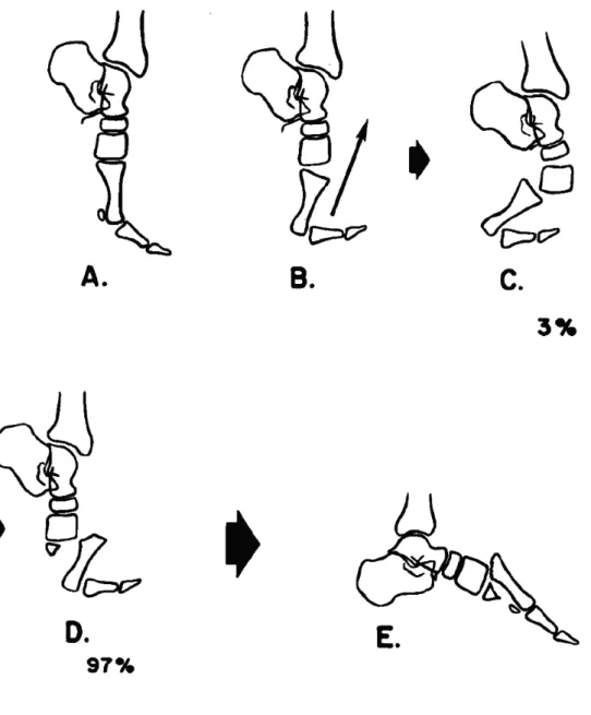 Figure 4.  Indirect injury mechanism by Myerson et. al (1986). (copyright SAGE publications