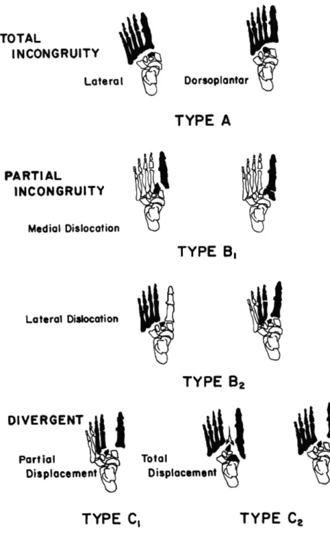 Figure 5.  The classification for Lisfranc injuries by Myerson et al. (1986), modified from the  classifications by Quenu and Küss and Hardcastle