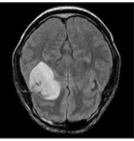 Figure 2: Examples of medical data. (a) A chest X-ray image (Irvin et al., 2019) and (b) a brain MRI image (Kaggle, 2020).