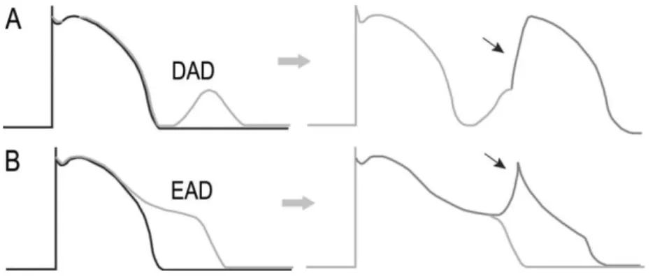 Figure  4.  Schematic illustrations  of  delayed  afterdepolarizations (DADs)  and  early  afterdepo- afterdepo-larizations (EADs)