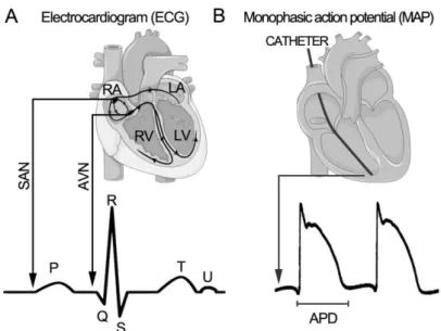 Figure  5. Clinical characterization of the electrical activity of the heart by ECG and MAP re- re-cordings