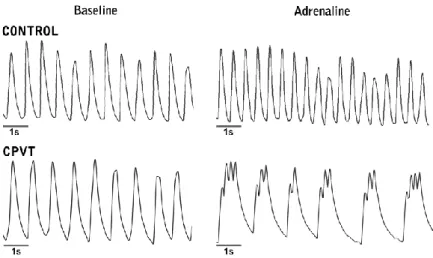 Figure  15.  Ca 2+  cycling transients  of  control  and  CPVT  CMs during  the spontaneous  baseline  beating  and  after  adrenaline  perfusion,  which  provoked  double  peaks  and  oscillating  Ca 2+    ab-normalities in CPVT CMs