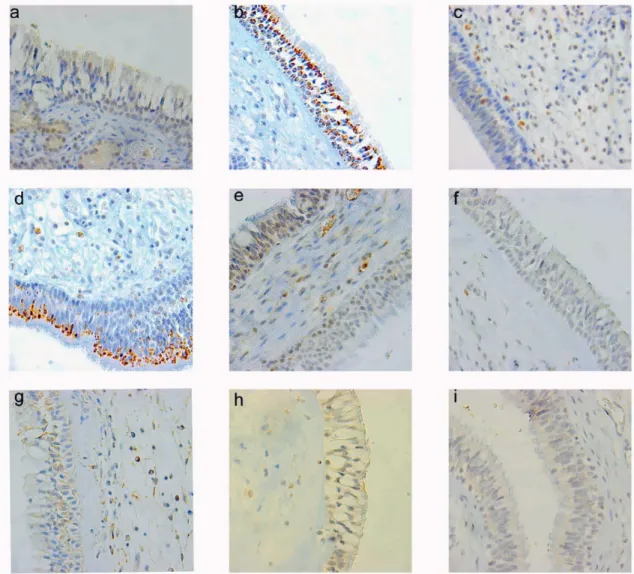 Figure 1. The expression of indoleamine 2,3-dioxygenase (IDO) in biopsies from the nasal cavity (a-d) and maxillary sinus mucosa (e-i)