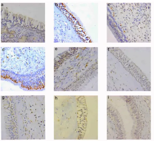 Figure 5 The expression of indoleamine 2,3-dioxygenase (IDO) in biopsies from the nasal cavity (a-d)  and maxillary sinus mucosa (e-i)
