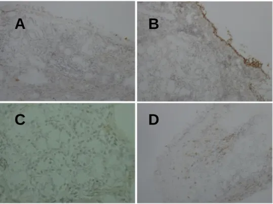 Figure  6  The  expression  of  indoleamine  2,3-dioxygenase  (IDO)  in  biopsies  from  the  nasal  cavity