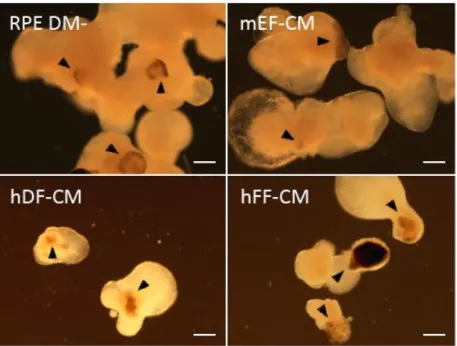Figure 5.1 Suspension cultures