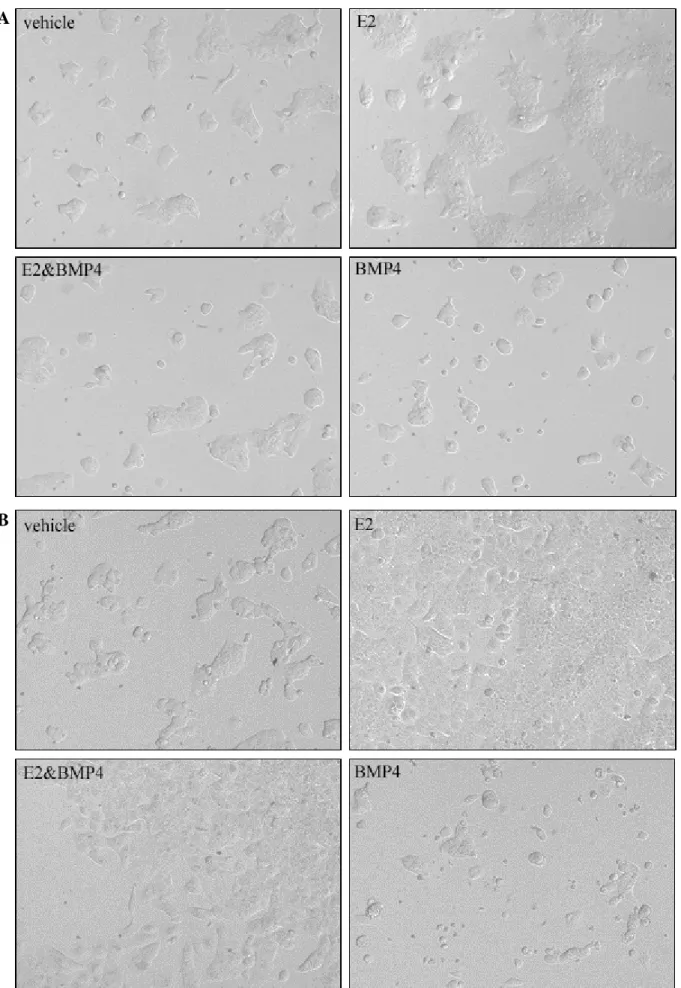 Figure 8: Light microscope pictures (10X magnification) of vehicle, estrogen (E2), E2 and BMP4, and BMP4 treated (A) BT-474 cells at day 7 and (B) T-47D cells at day 5.