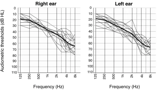Figure 7. Results of the pure-tone air-conduction audiometry for the  elderly hearing-impaired participants in Study 2