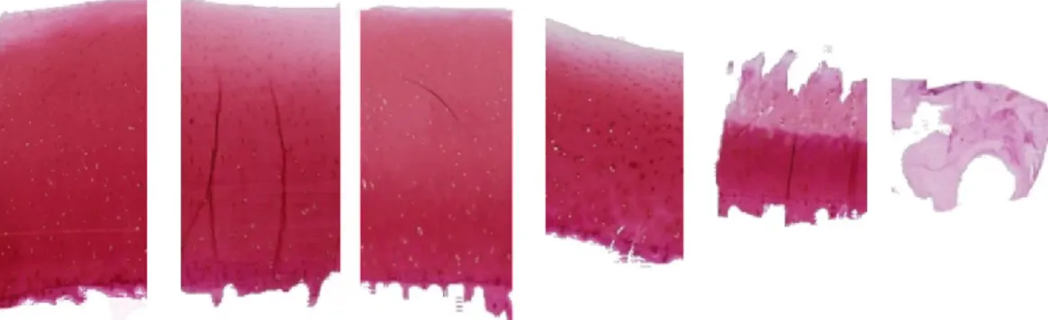 Figure 2.3: Microscopic evaluation samples of the OARSI system. From  left to right, slices are given the grades of 0, 1, 2, 3, 4, 5.25