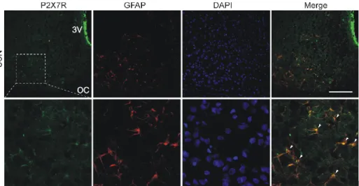 Obrázek  7.  Buněčná  lokalizace  P2X7  receptoru  v  SCN.  Imunohistochemické  značení  potkanního  hypotalamického řezu s SCN, optickým chiasmem (OC) a třetí mozkovou komorou (3V)