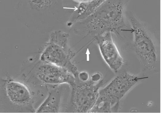 Figure 1: A phase contrast image of subconfluent T24 cells. Cells have numerous vacuoles (grey- (grey--white  circular  structures  in  cells,  marked  by  white  arrow)  and  inclusion  bodies  (black  circular  structures in cells, marked by black arrows