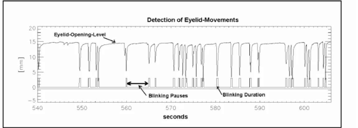 Figure 3. Sample output from eyelid recording (Source: Hans-Peter Krüger) 