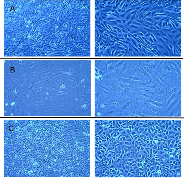 Figure 11: ASK-1, SHK-1 and CHSE-214 cells. All pictures were acquired with light microscope