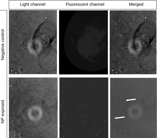 Figure 14: SHK-1 cells exposed to polystyrene nanoparticles of 503 nm with Plum Purple fluorescence