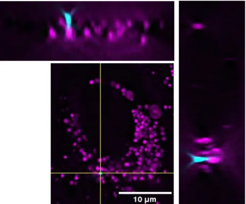Figure 20: 2D images from DeltaVision™ of SHK-1 cells. Lysosomes are stained with LysoTracker™ Deep Red  (LDTR) before imaging