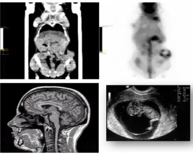 Figure 2.  Images acquired with PET, CT, MRI [54] and US [55]. The upper left image is a CT image  of a mouse, the upper right image is a PET image of a mouse, the lower left image is a MR image  of a human and the lower right image is a US image of an emb