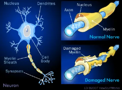 Figure 1: Damage on nerves in MS 