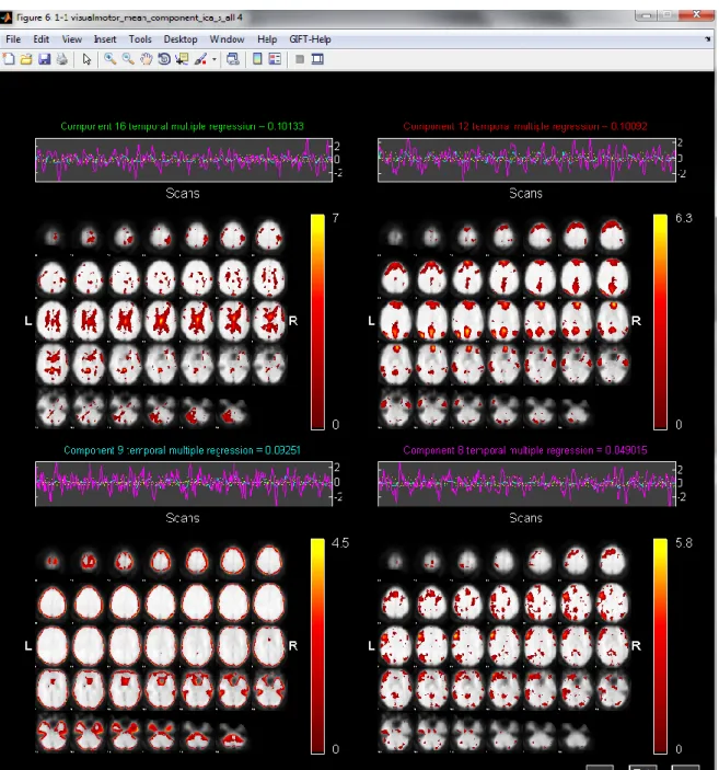 Figure 4-4 Selected projections of 4 components on a low-resolution template brain after being sorted on  a  temporal  manner  using  multiple  regression  on  all  data  on  all  timecourses