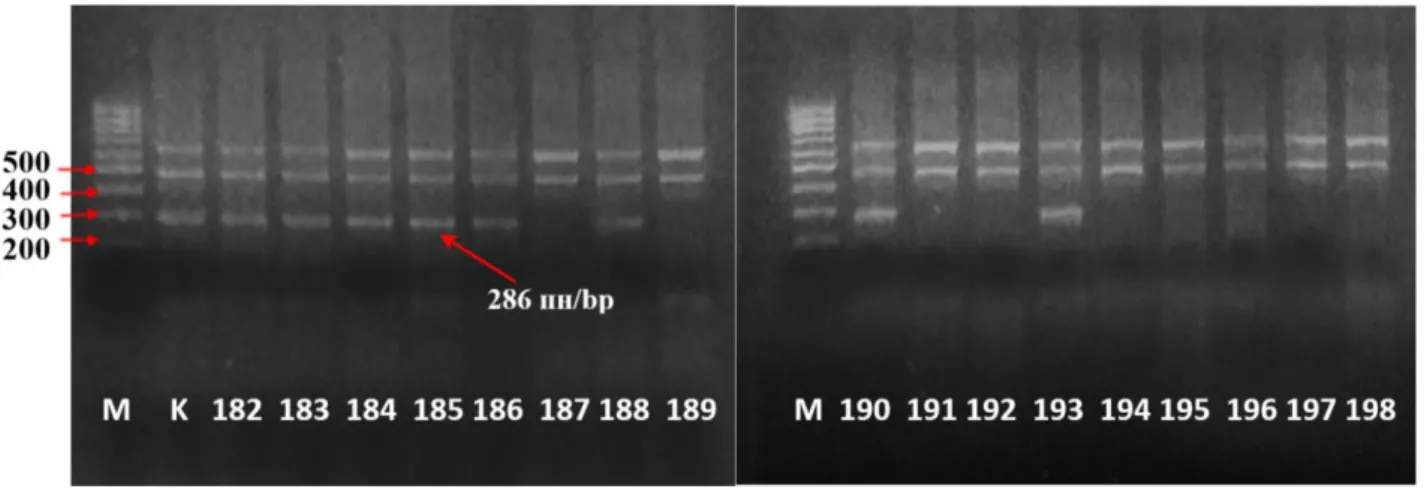 Fig. 3. Electrophoregram of PCR products amplified using primer  pair VfC1F+VfC2R. 