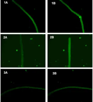 Fig. 1. 1A, 2A, 3A: intact fibres, loaded with Fuo-3 fluorescent dye; 1B: carbachol  treatment; 2B: carbachol treatment in Ca 2+  free medium; 3B: carbachol treatment,  preincubation with verapamil (10uM)