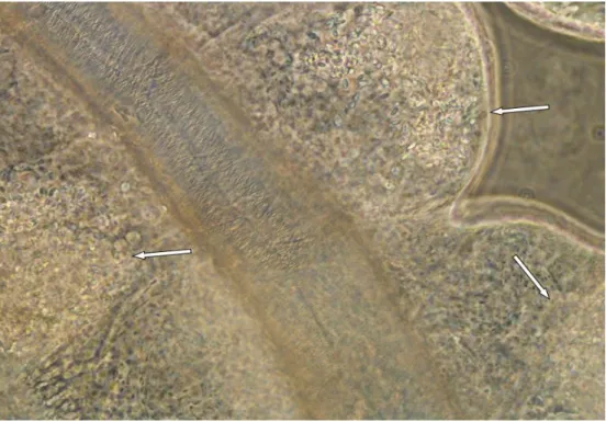Fig.  4  12  dpi:  Silk  glands  of  L.  dispar   larva  infected  with  N.  lymantriae 