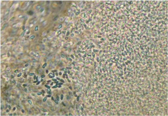 Fig. 10 20 dpi: Tissue of silk glands was densely filled with spores. 