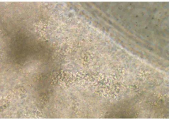 Fig. 11 20 dpi: Malpighian tubules were full of environmental spores. 