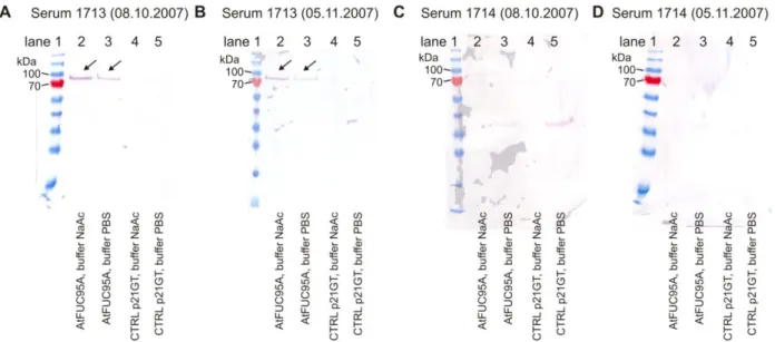 Figure  25:  Testing  of  rabbit  sera  against  AtFUC95A  protein  by  Western  Blot  analysis  on  transiently  expressed  AtFUC95A and empty vector control p21GT.  