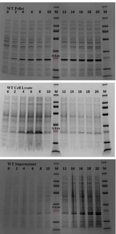 Figure  13.  SDS  PAGE  Gel  of  treated  pellet  after  cell  lytic  treatment-  and  supernatant  after  TCA  precipitation  protocol