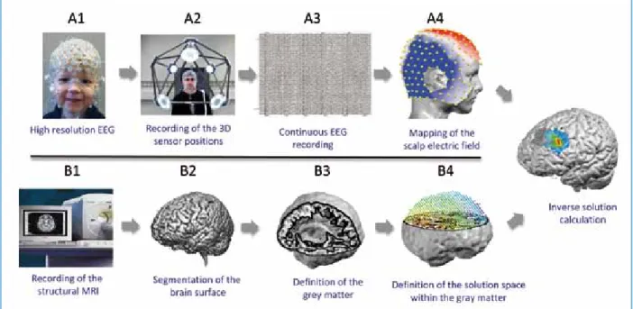 Figure 1: Principle of EEG Source Imaging