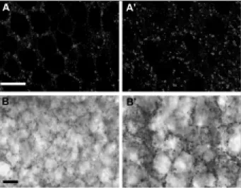 Figure 4: Up-regulation of GABA A receptors (A-A’) and GABAer- GABAer-gic axons (B-B’) in the granule cell layer during the chronic phase after KA treatment
