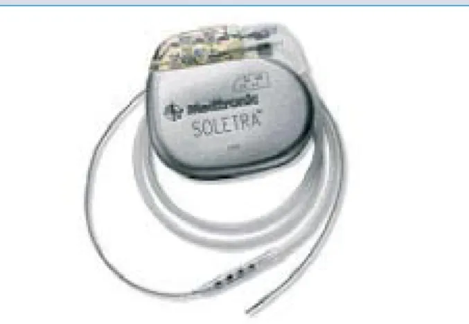 Figure 1: Exemple d’un stimulateur intracrânien (Soletra® et faisceau d’électrodes implantable, Medtronic Inc,  Minneapo-lis, Minnesota, USA).