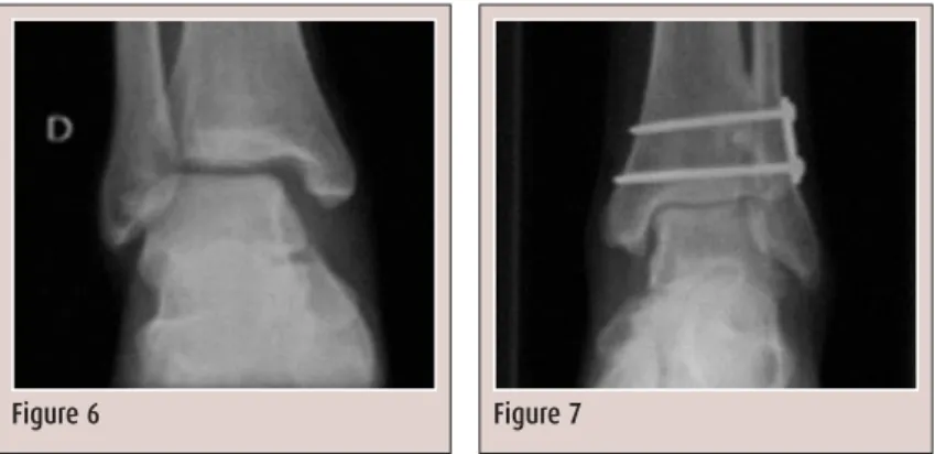 Figure 6 Figure 7