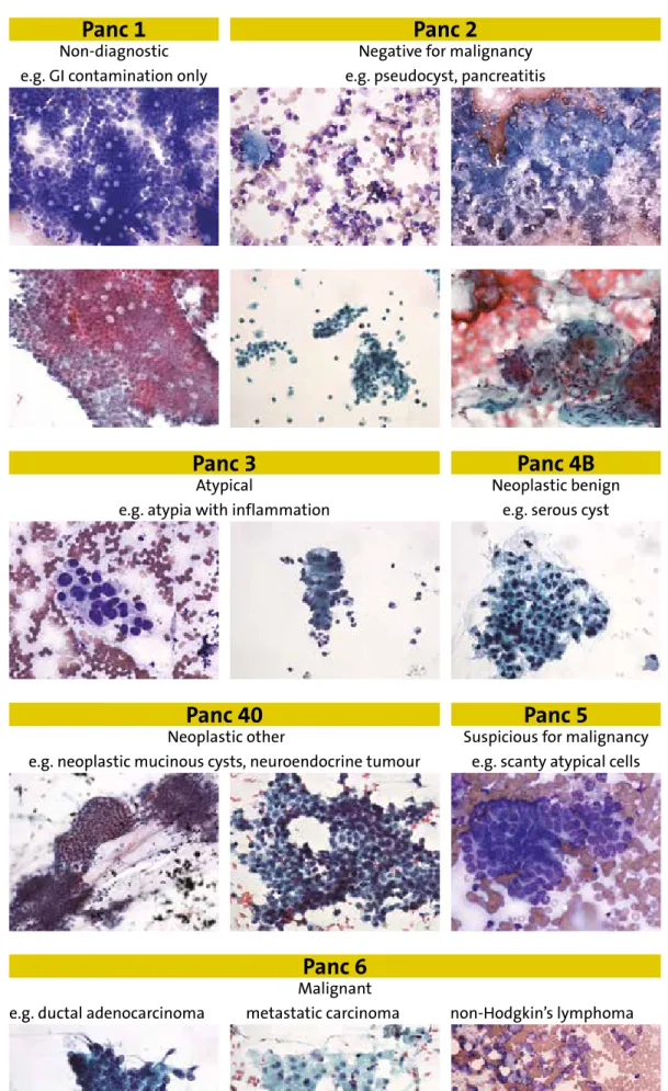 Table 3: Cytological  diagnostic codes with  examples for each  category